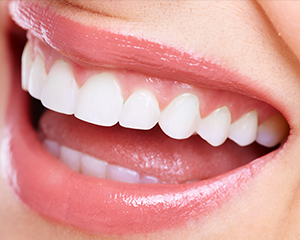 審美治療・矯正歯科で自然な歯の美しさを手に入れませんか？